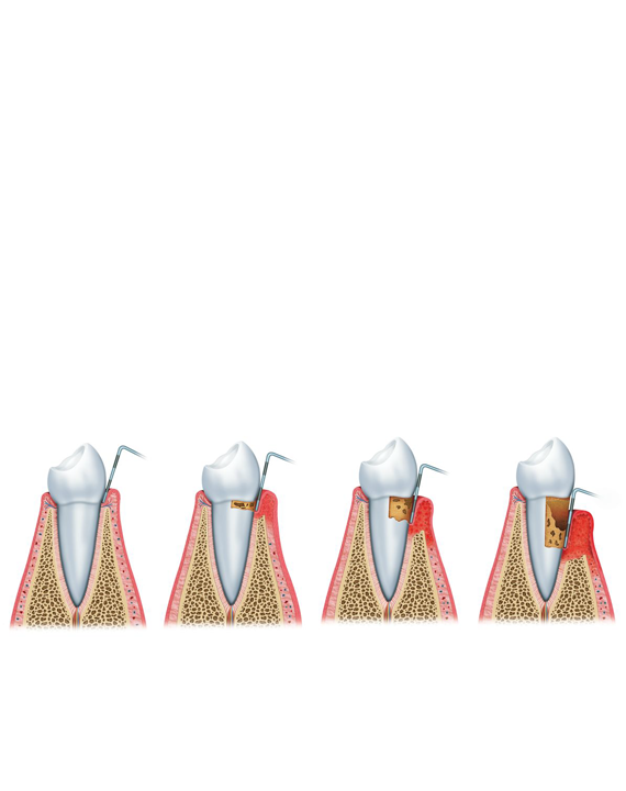 Periodoncia Córdoba